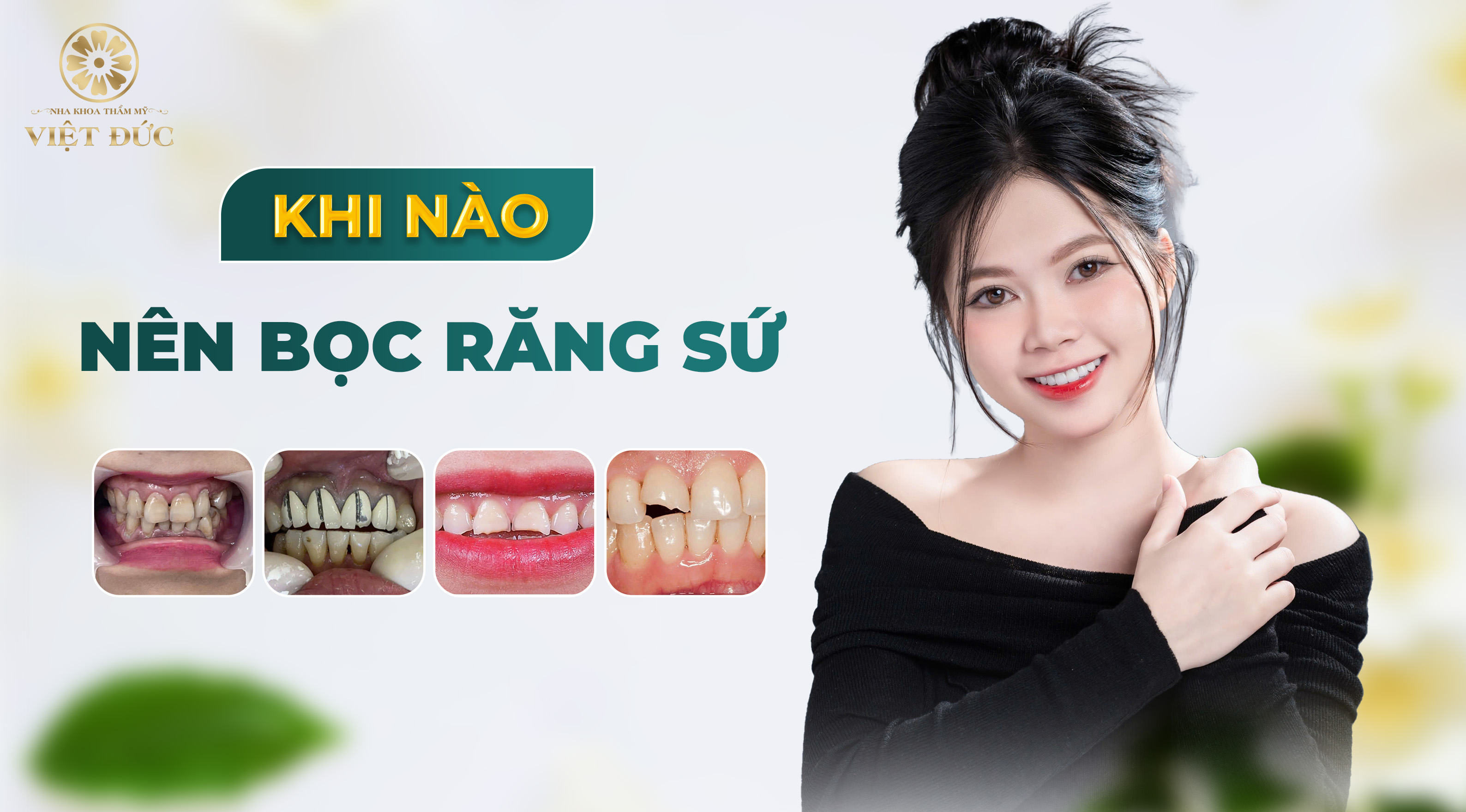 khi nào nên bọc răng sứ